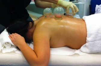 Cupping Therapy - Acupuncture